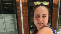 Nuria Gil sufri� magulladuras en todo su cuerpo en el accidente