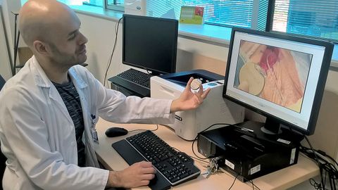 El doctor Javier Sol, director del equipo de Neurocirug�a del Hospital Universitario Central de Asturias (HUCA), muestra el dispositivo que colocan a los pacientes con epilepsia.El doctor Javier Sol, director del equipo de Neurocirug�a del Hospital Universitario Central de Asturias (HUCA), muestra el dispositivo que colocan a los pacientes con epilepsia