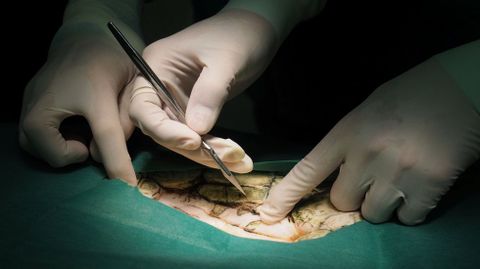 La tortuga Omsin (�hucha�), de 25 year, se trag� casi mil monedas.