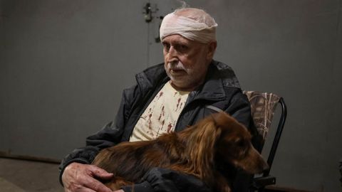 Un hombre herido durante el bombardeo de Rusia sobre Kiev