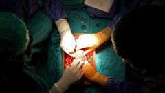 Trasplante de ri��n en el Chuac