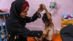 Una madre junto a su hijo desnutrido en el hospital Al Nasser de Gaza.