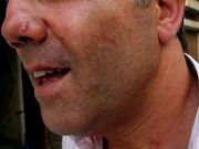 La v�ctima sufri� agresiones en la cara y en el cuerpo. 