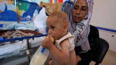 Una mujer logra alimentar a su hijo malnutrido en un hospital de Gaza. Israel bloquea la entrada de ayuda a la Franja