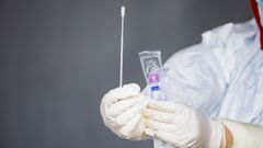 Sanidad suma 585 fallecidos m�s en un d�a con discrepancias en las estad�sticas