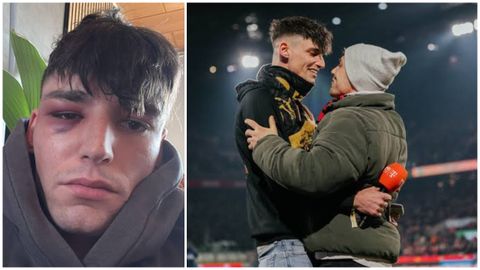 En la primera imagen, Pascal Kaiser, tras la agresi&oacute;n en su casa; en la segunda, el joven colegiado, durante la pedida de mano a su pareja.