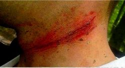 En Facebook se difundieron im�genes de casos fuera de Galicia.