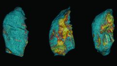 Pulmones de rat�n sanos (azules), da�ados por la ventilaci�n mec�nica (manchas amarillas) y recuper�ndose de los da�os (menos amarillo).Pulmones de rat�n sanos (azules), da�ados por la ventilaci�n mec�nica (manchas amarillas) y recuper�ndose de los da�os (menos amarillo)