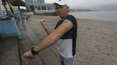 Roberto Pérez Míguez, tras ser picado por una carabela portuguesa, en imagen de archivo en la playa de Celeiro, donde ahora se baña más para evitar riesgos al nadar mar adentro