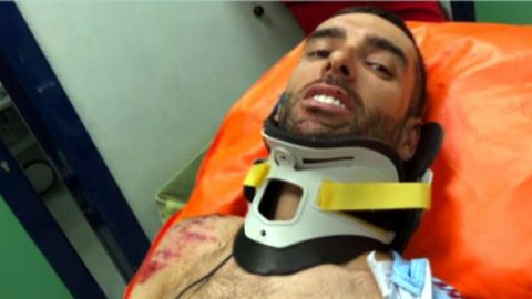 Dani Navarro, hospitalizado tras su grave ca�da en el Giro