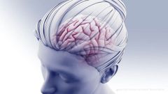 Ilustracin del cerebro con Alzheimer