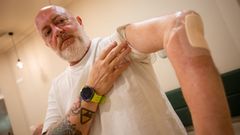 David Vega, este mi�rcoles en Pontevedra, muestra su maltrecho brazo izquierdo, a la espera de una operaci�n de prioridad 2 para retirar el hueso y ponerle una pr�tesis