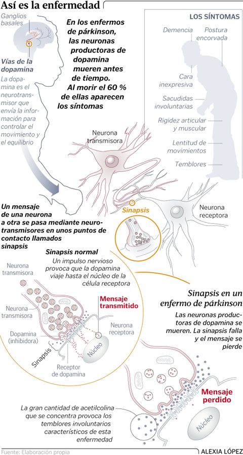 As es la enfermedad