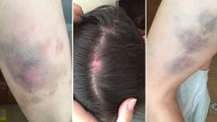 La hermana de la agredida por Silva Charl�n grab� el momento