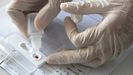 Test r�pido para detectar el coronavirus