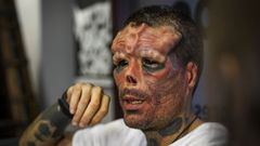 Henry Rodr�guez, tres a�os de operaciones para parecerse a Red Skull