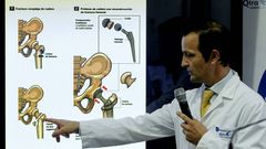 El doctor �ngel Villamor explica los detalles de la operaci�n