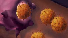 Clulas de melanoma.