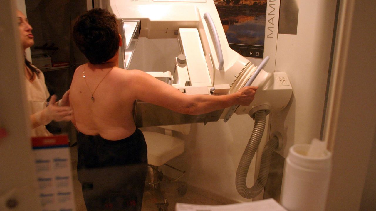 El adelanto del cribado de cáncer de mama a los 45 años beneficiará a 117.000 gallegas