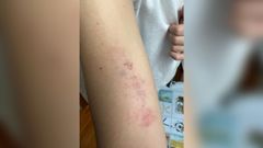 El repartidor sufri� varias lesiones al ser asaltado durante una entrega.