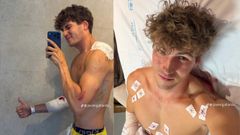 Accidente de moto de Javier Gallardo