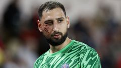 Donnarumma tras la entrada de Singo durante el PSG - AS Monaco de la Ligue 1