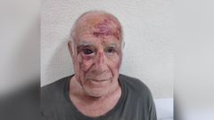 Domingo, tras ser agredido la maana del mircoles en Torre Pacheco por un grupo de jvenes.