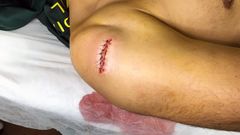 La herida del agente en el atraco de Cangas de On�s