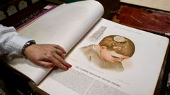 El atlas de la piel ilustrado del dermat�logo Jos� Eugenio de Olavide