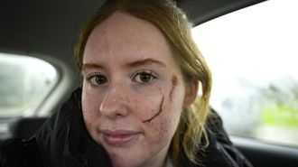 Noa Seijo, la joven conductora de Caldas a la que le cay� un pino encima.