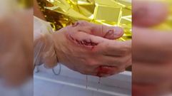 Un tirbur�n ataca a un ba�ista en Elche