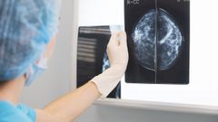 Resultado de una mamograf�a. 