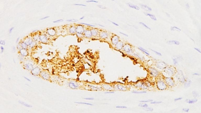 Fotograf�a facilitada por el CSIC sobre su prototipo de test para detectar c�ncer de p�ncreas