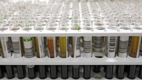 Imagen de archivo del CHUO de varias pruebas de orina.