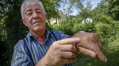 Una de las avispas atac� a Manuel Abeij�n en una mano, y otras velutinas le picaron en la cabeza