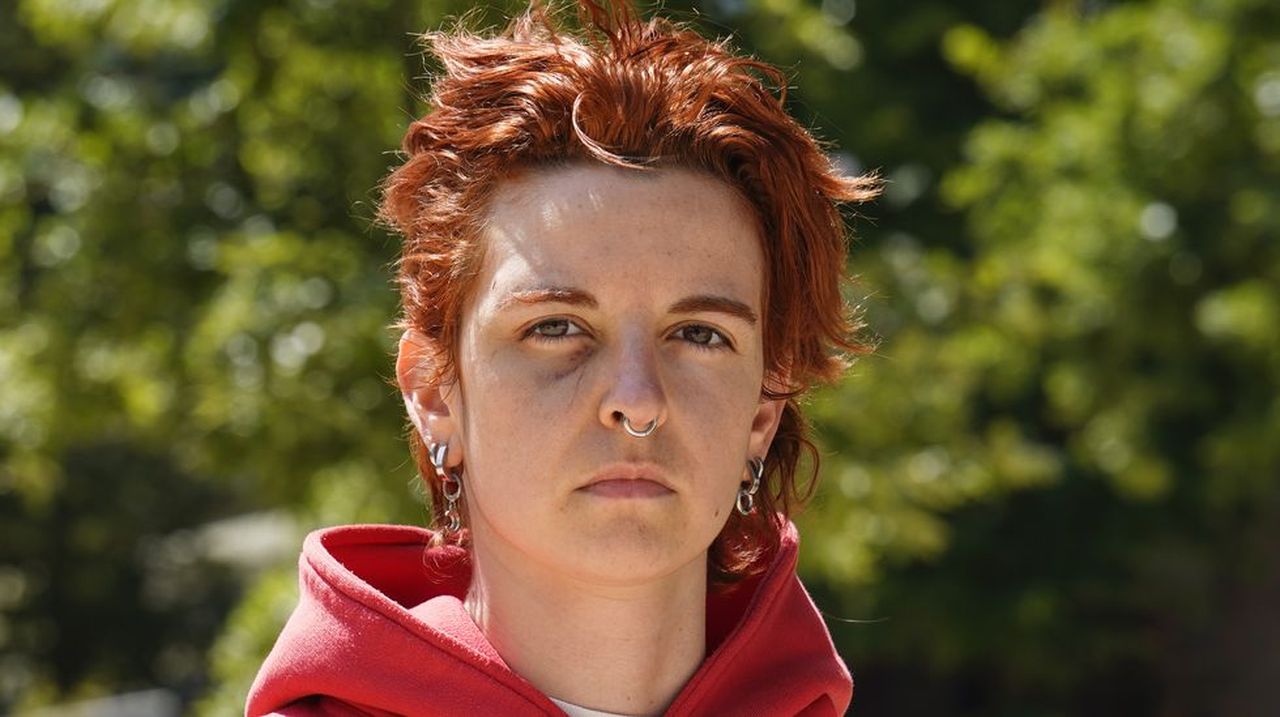 Una joven que iba sola en Pontevedra recibió un botellazo de unos desconocidos: «Me llamaron bollera y luego sentí el golpe»