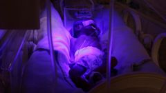 Un beb� reci�n nacido, recibiendo ox�geno en una incubadora en un hospital de Bolivia
