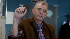 Abel V�zquez Pardo, de 60 a�os, sigue rehabilitaci�n para recuperar las funciones de la mano que le reimplantaron