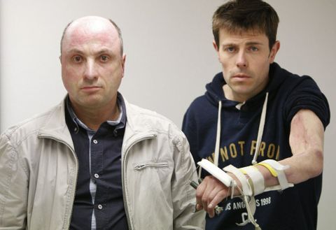 <span lang= es-es >Otros trabajadores accidentados</span>. Lino Grueiro (izquierda) sufrió graves quemaduras en el 2011 en la nave de Betanzos. A su lado, Javier muestra el brazo lesionado en abril del 2014. 
