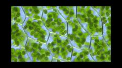 Visi�n ao microscopio de c�lulas vexetais, onde poden observarse os cloroplastos, nos que se atopa a clorofila