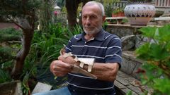 Andr�s Ruso denuncia que lleva 13 meses esperando por una consulta con el traumat�logo para poder entrar en quir�fano y operarse del t�nel metacarpiano