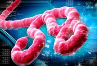 El �bola es un filovirus formado por una peque�a part�cula y una envuelta. 