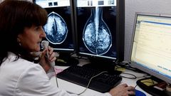 Unidad de c�ncer de mama en el hospital Meixoeiro de Vigo