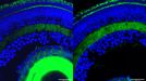 A la derecha, la retina de un pez cebra con el gen desactivado. La imagen de la izquierda muestra la visi�n normal.