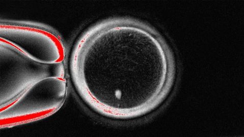 vulo humano con transferencia nuclear de clulas somticas (SCNT), con el huso visible (punto brillante en el interior) antes de la fertilizacin