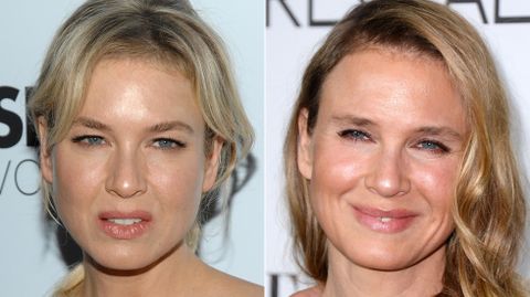 La actriz Ren�e Zellweger ha sido la �ltima en sumarse a este peculiar lista