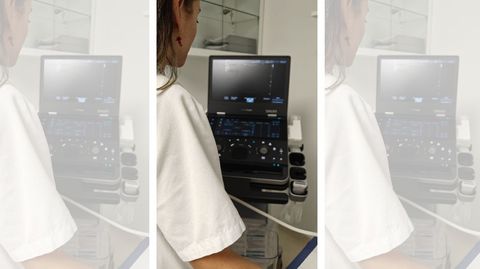 Nuevo ec�grafo m�vil destinado al centro de salud de Caranza.