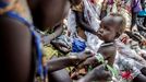 Medicin del nivel de malnutricin de un nio en un campo de refugiados de Etiopa.