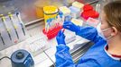 Los an�lisis moleculares confirmaron la persistencia del virus