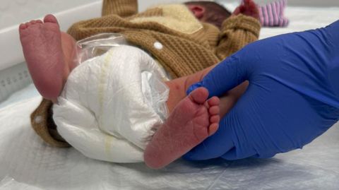 Beb� al que le van a hacer la prueba del tal�n en el CHUO.